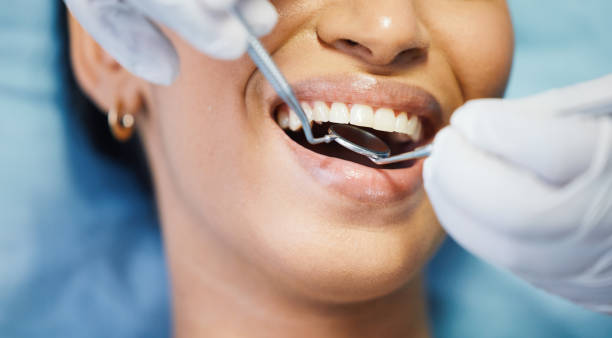 Best Emergency Dentist for Lost Fillings or Crowns in Brices Creek, NC